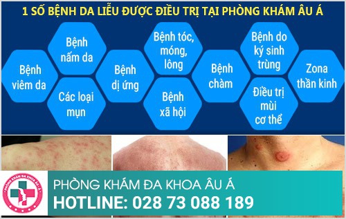 phòng khám da liễu âu á