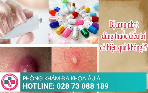 Bị mụn nhọt dùng thuốc điều trị có hiệu quả không?
