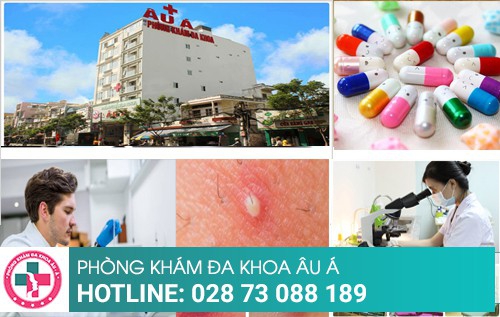 Bị mụn nhọt dùng thuốc điều trị có hiệu quả không?