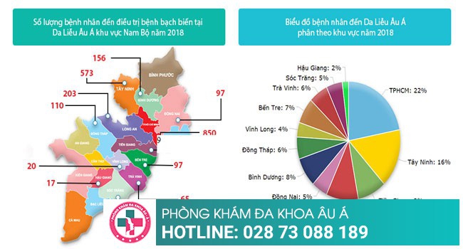 Cách điều trị bệnh bạch biến giúp bệnh nhân lấy lại sự tự tin