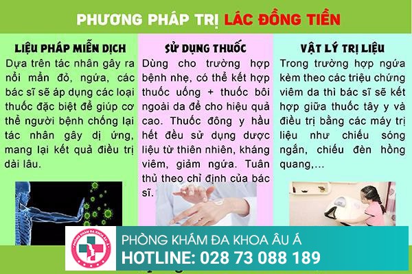 Cách trị bệnh lác đồng tiền hiệu quả nhất