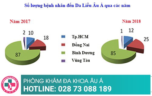 Cách trị bệnh lác đồng tiền hiệu quả nhất