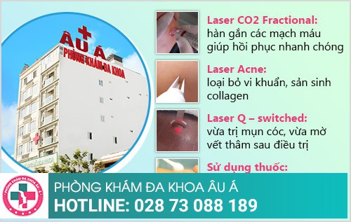 Cách điều trị mụn cóc ở chân hiệu quả, tiết kiệm
