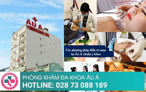 Cách trị mụn bằng những phương pháp tiên tiến