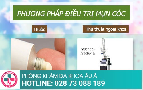 Cách trị mụn cóc tại Phòng Khám Da Liễu Âu Á