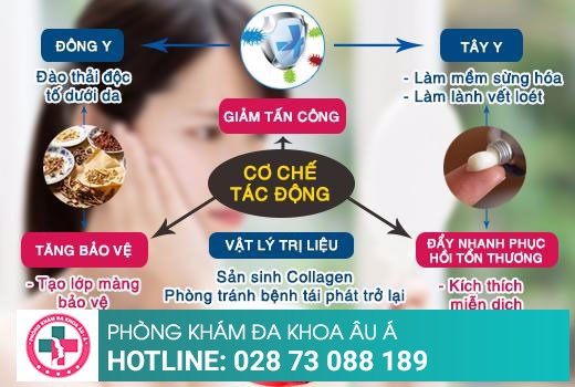 Viêm da cơ địa