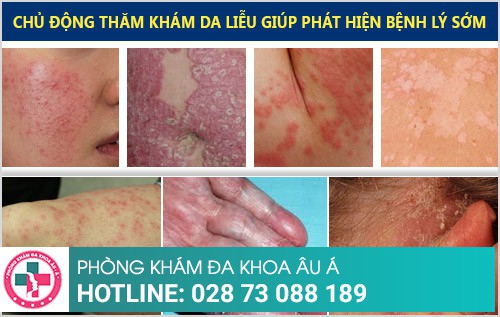 bệnh viện da liễu quận 7
