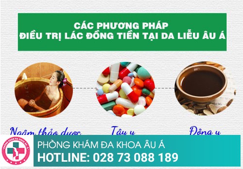 Chữa lác đồng tiền như thế nào hiệu quả, an toàn