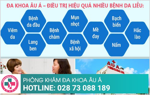 Bệnh viện da liễu ở đâu tốt nhất Tp HCM?