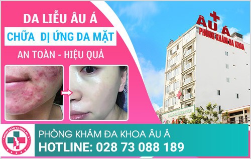 Dị ứng da mặt