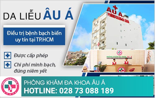 khám bạch biến