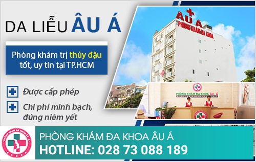 bệnh thủy đậu
