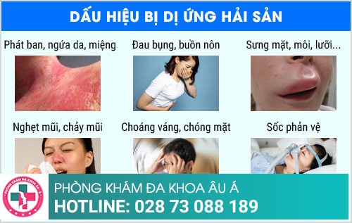 điều trị ứng hải sản