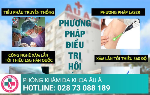 Địa chỉ điều trị hôi nách uy tín tại TPHCM 