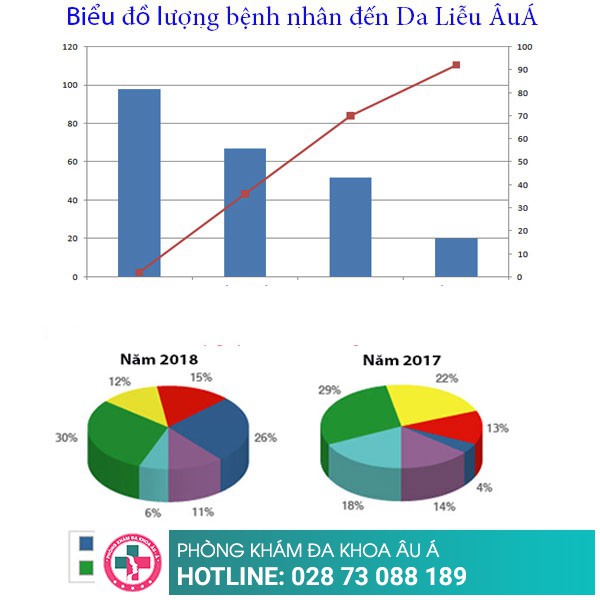 Địa chỉ trị nấm da đầu hiệu quả, khả năng tái phát thấp