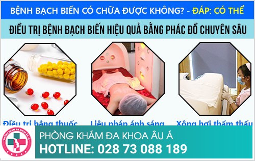 Bệnh bạch biến có chữa được không?