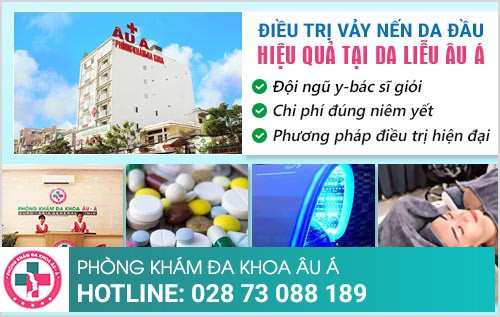 vảy nến da đầu