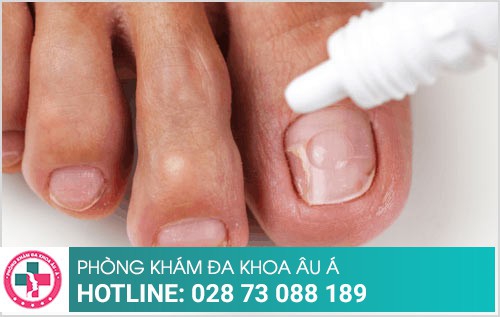 thuốc trị nấm móng