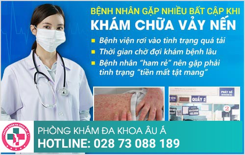 chữa vảy nến ở đâu