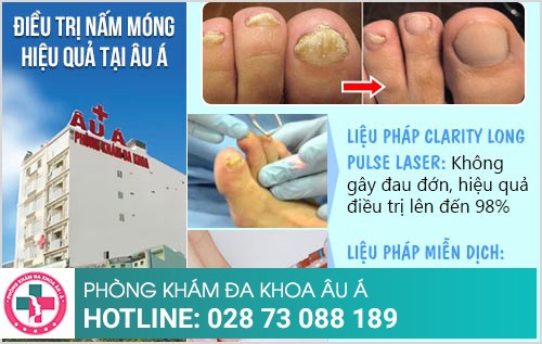 thuốc trị nấm móng