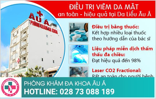 điều trị viêm da mặt