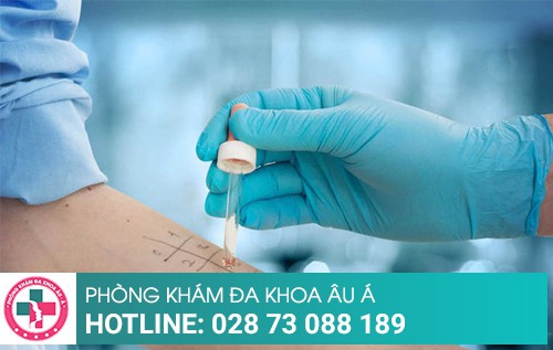 nổi mụn nước ở chân