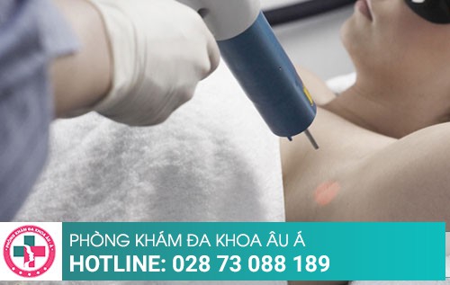 Cách trị mụn lưng đơn giản, đạt hiệu quả cao