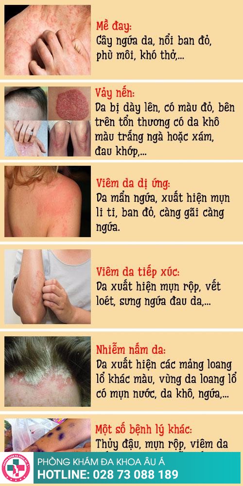 Ngứa khắp người: Nguyên nhân, dấu hiệu và cách điều trị