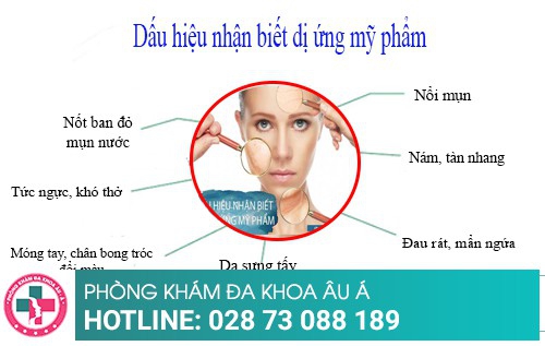 Nguy hại cần cảnh giác khi bị dị ứng mỹ phẩm