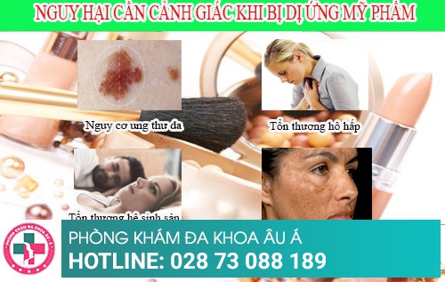 Nguy hại cần cảnh giác khi bị dị ứng mỹ phẩm
