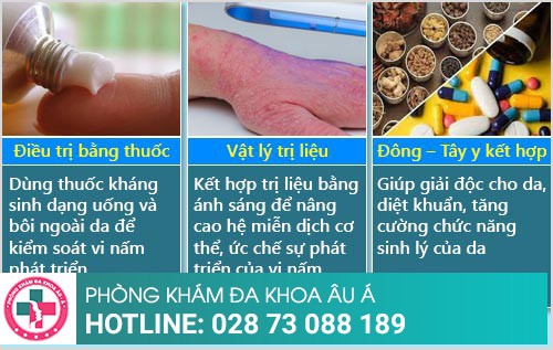 bệnh chàm hóa