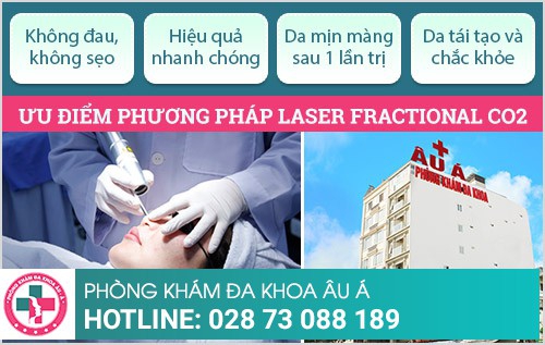 Viêm da tiết bã