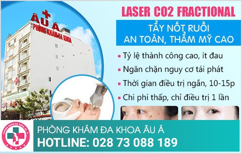 Có nên tẩy nốt ruồi ở bệnh viện da liễu TP.HCM