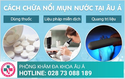 chữa nổi mụn nước