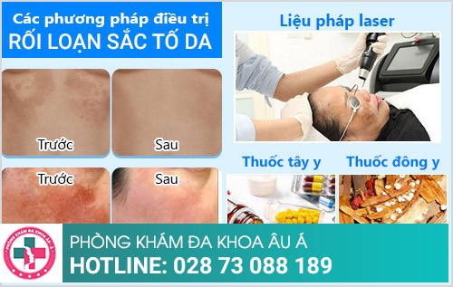 cách trị rối loạn sắc tố da