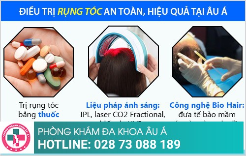 Nên điều trị rụng tóc ở đâu tại TPHCM?