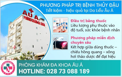 chữa bệnh thủy đậu 