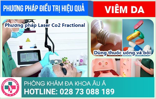 Địa chỉ chữa bệnh viêm da uy tín tại TP.HCM