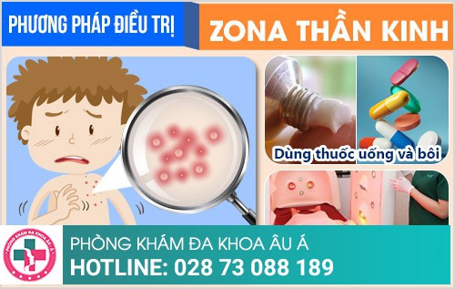 zona thần kinh