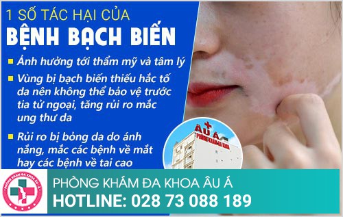 dấu hiệu bạch biến