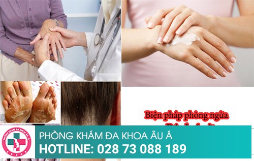 Tổng hợp các kiến thức về bệnh á sừng