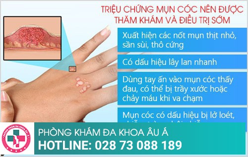 Phòng khám điều trị mụn cóc ở TP.HCM