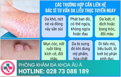 Bác sĩ tư vấn da liễu online