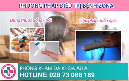 Zona thần kinh và cách điều trị đúng đắn