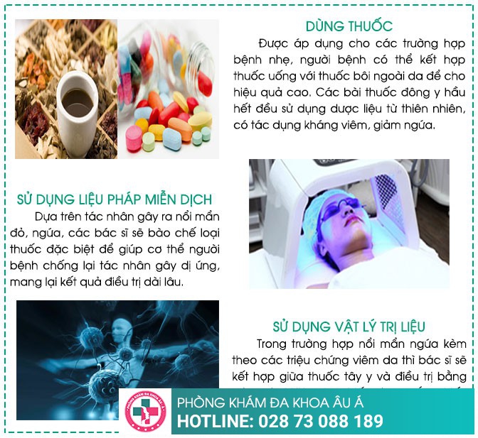 Bệnh á sừng: Nguyên nhân, triệu chứng và cách điều trị