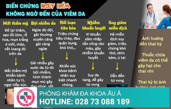 Biến chứng nguy hiểm của bệnh viêm da mà bạn chưa ngờ tới