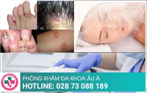 Công nghệ điều trị nấm hiệu quả chỉ sau một liệu trình