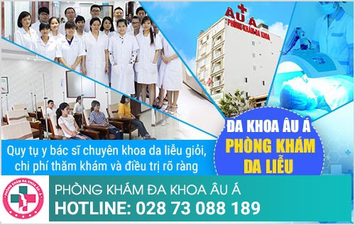 điều trị ứng hải sản điều trị ứng hải sản