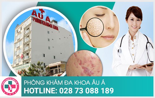 Da liễu Âu Á - Địa chỉ khám bệnh ngoài da uy tín tại TPHCM