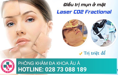 Nổi mụn ở mặt nguyên nhân và cách điều trị như thế nào?